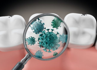 ”ΣΧΕΣΗ ΟΥΛΙΤΙΔΑΣ – ΠΕΡΙΟΔΟΝΤΙΤΙΔΑΣ ΚΑΙ COVID 19”, από τη Χειρουργό Οδοντίατρο Μαρία Αγραπίδου