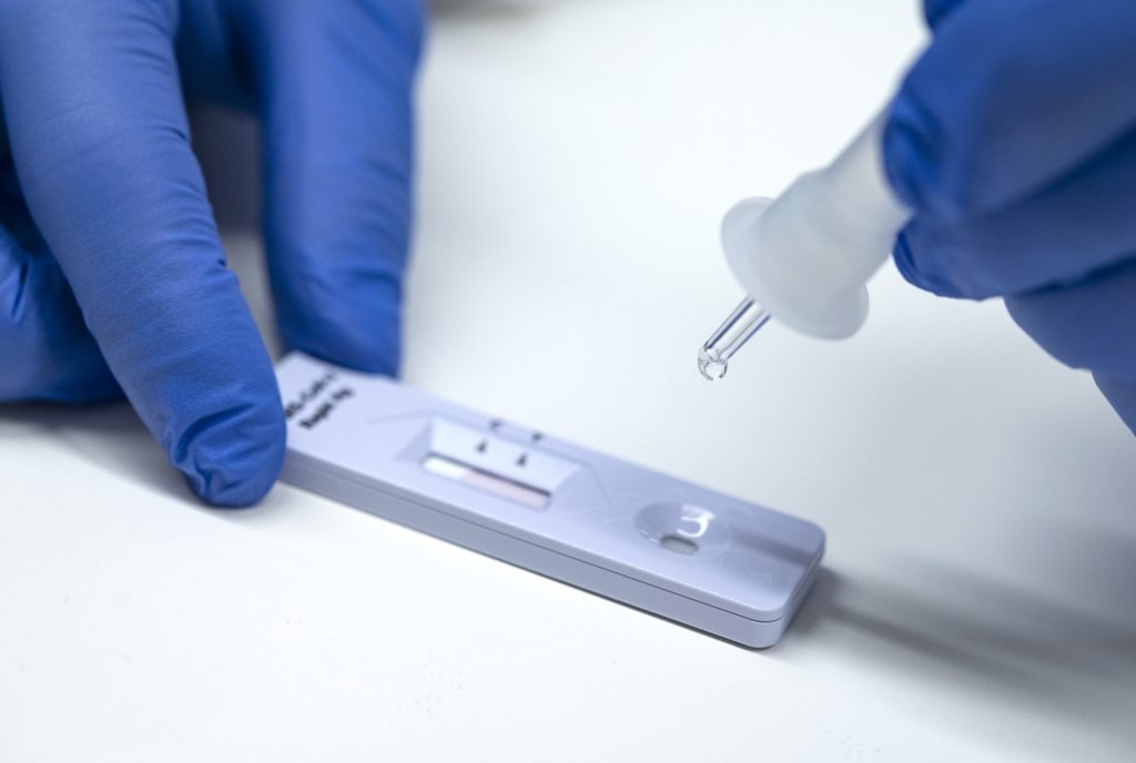 Δωρεάν Rapid Tests ανίχνευσης Covid-19 στο Δήμο Πεντέλης την Παρασκευή 12 Μαρτίου 3 Δωρεάν Rapid Tests ανίχνευσης Covid-19 στο Δήμο Πεντέλης την Παρασκευή 12 Μαρτίου
