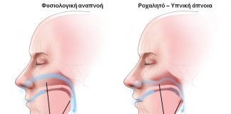 Δημοτικά ιατρεία
Παγκόσμια ημέρα Υγείας
Χρόνιο Ροχαλητο
Εκατοντάδες χιλιάδες άνθρωποι,κυρίως άντρες αλλά και γυναίκες ταλαιπωρούνται από το ροχαλητό και τις τραγικές του συνέπειες.Το χειρότερο όμως είναι ότι οι περισσότεροι έχουν συμβιβαστεί με αυτό….