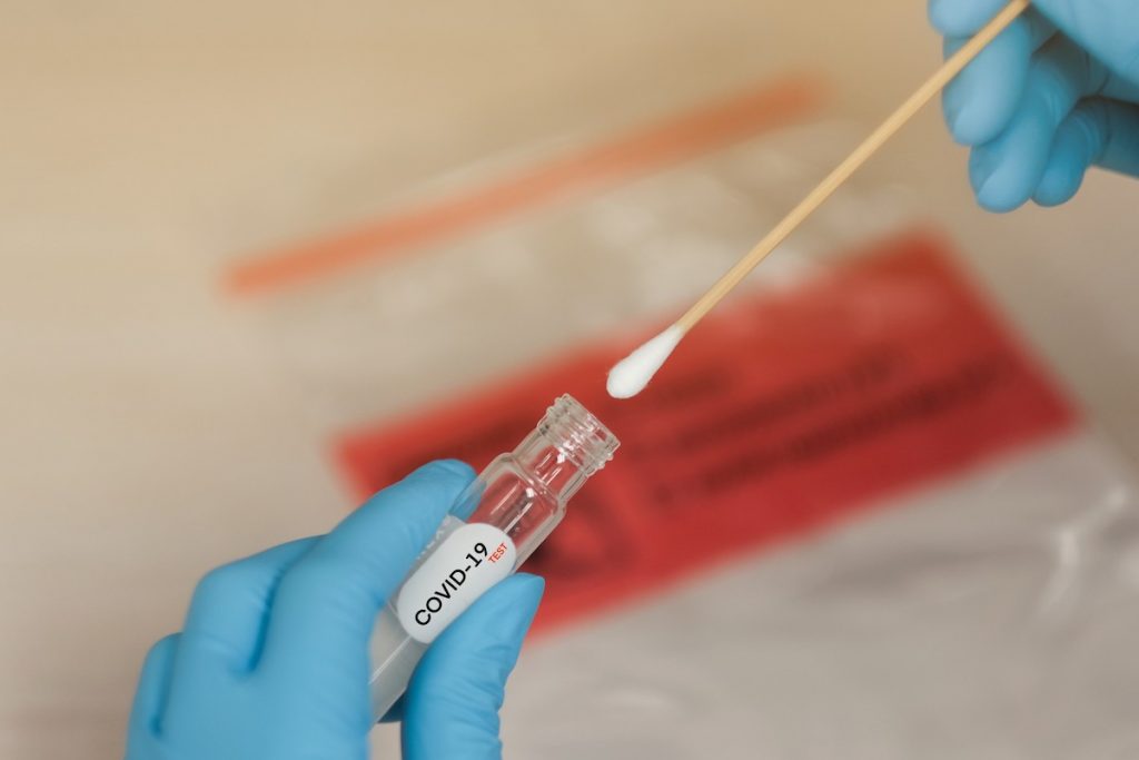 Πότε θα γίνονται δωρεάν rapid test στον Δήμο Χαλανδρίου, τον Ιούλιο 2022